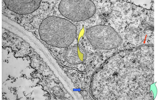 Figura 26: Detalles de una célula de raíz de Lupino. Imagen tomada con Microscopio Electrónico de Transmisión (MET). Cedida por Prof. de Felipe (C.C.M.A. CSIC Madrid)