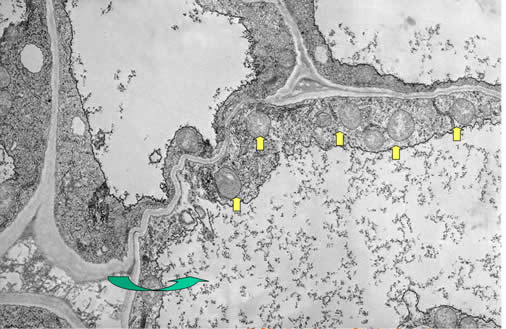Figura 27: Vacuolas y mitocondrias de una célula de raíz de Lupino. Imagen tomada con Microscopio Electrónico de Transmisión (MET). Cedida por Prof. de Felipe (C.C.M.A. CSIC Madrid)