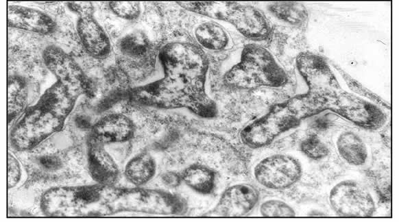Figura 28: Bacteroides de Bradyrhizobium japonicum procedentes de nódulos de soja. Imagen tomada con Microscopio Electrónico de Transmisión (MET). Cedida por Dra. Fernández Pascual (C.C.M.A. CSIC Madrid)