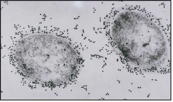 Figura 29: Azospirillum brasilensis. Imagen tomada con Microscopio Electrónico de Transmisión (MET). Cedida por Dra. Fernández Pascual (C.C.M.A. CSIC Madrid)